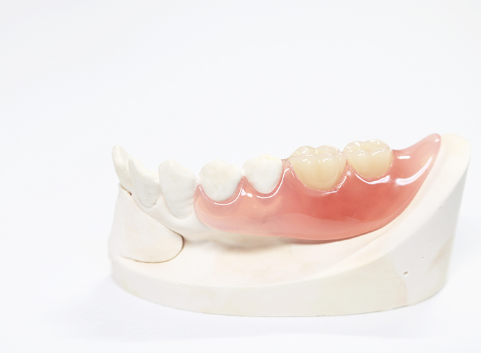 目立ちにくい入れ歯の製作にも対応いたします