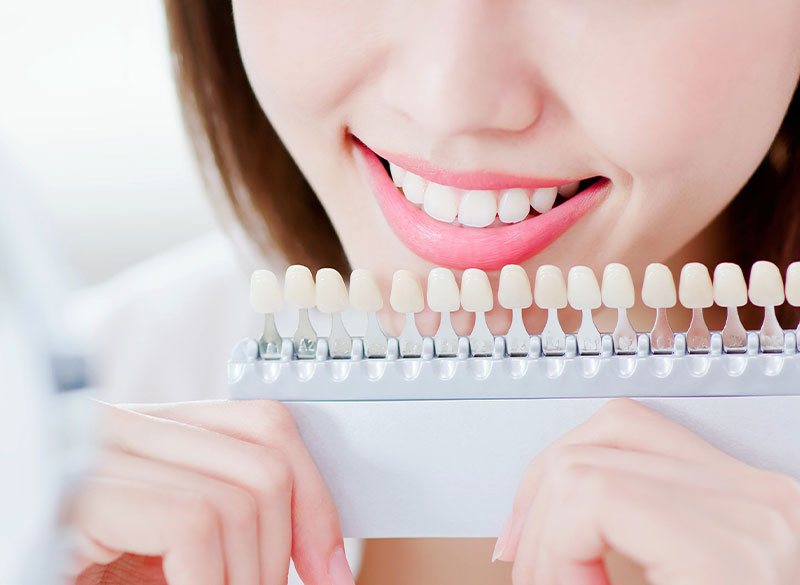 ホワイトニング