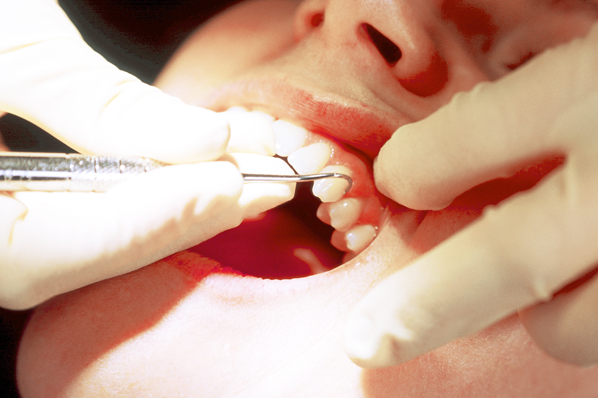 歯周病治療に力を入れています